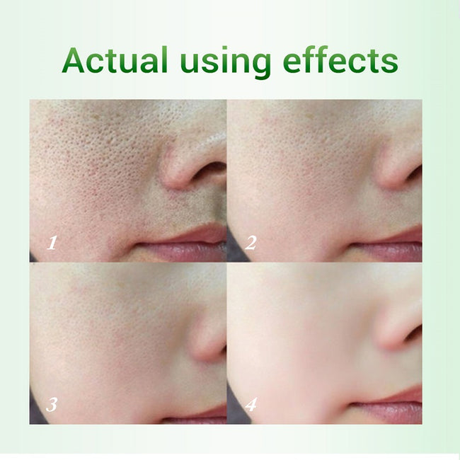 Salicylic Acid Pore Refinement Cream Lotion Skin Rejuvenation Cream Skin Care Products Main Image